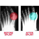 BUNION CORRECTOR (1PAIR)