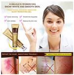 Acne Scar Cream ( New version )
