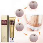 Acne Scar Cream ( New version )