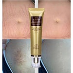 Acne Scar Cream ( New version )